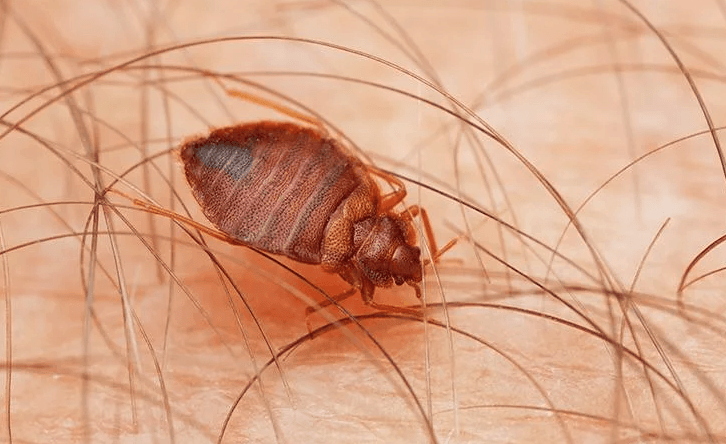 image of a bug on skin