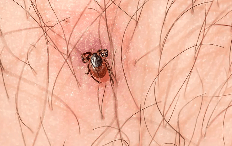 image of bed bug on skin