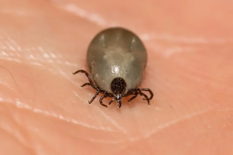 Blacklegged deer tick attached to human skin during feeding.