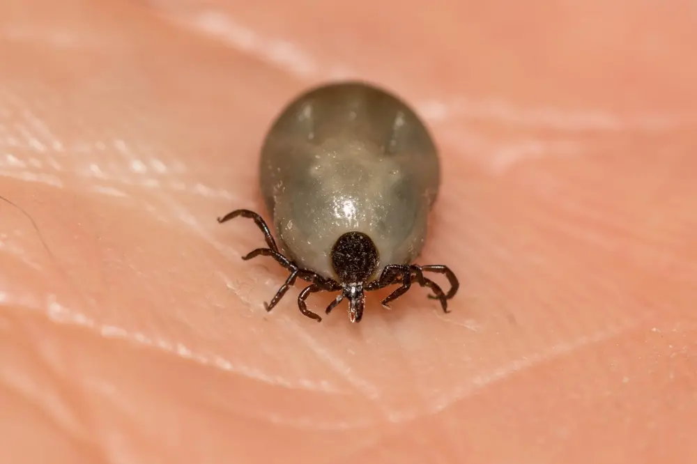 Blacklegged deer tick attached to human skin during feeding.