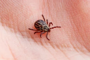 Close-up of a tick attached to human skin, showing a common ticks infestation risk.
