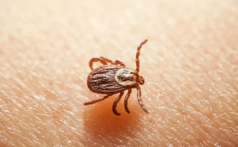 Close-up of a tick attached to human skin, showing common ticks pest activity.